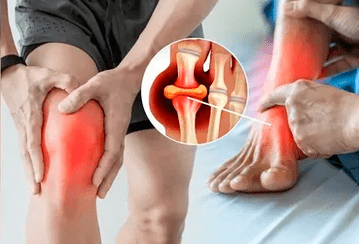 Schema voor het aanbrengen van Icexin-gel op het gebied van het kniegewricht en de voet